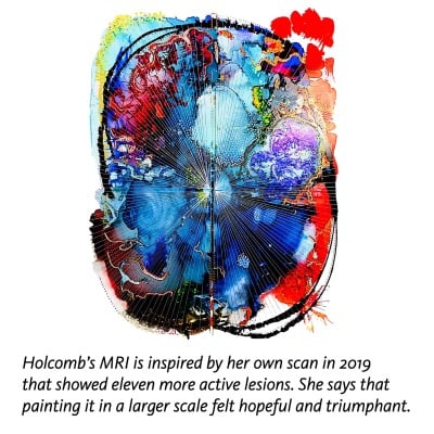 Holcomb's MRI scan